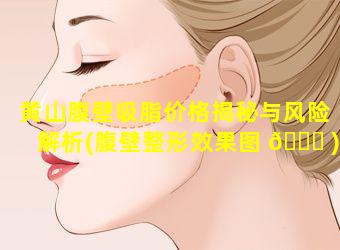 黄山腹壁吸脂价格揭秘与风险解析(腹壁整形效果图 🐋 )